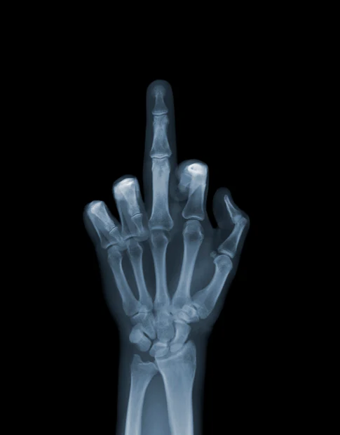 The Finger - Image 2